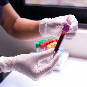 Pobieranie krwi  - warsztat dla Opiekunów Medycznych z 45 punktami edukacyjnymi - Kraków