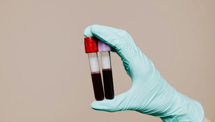 pexels-karolina-grabowska-4040563 pexels-karolina-grabowska-4040563